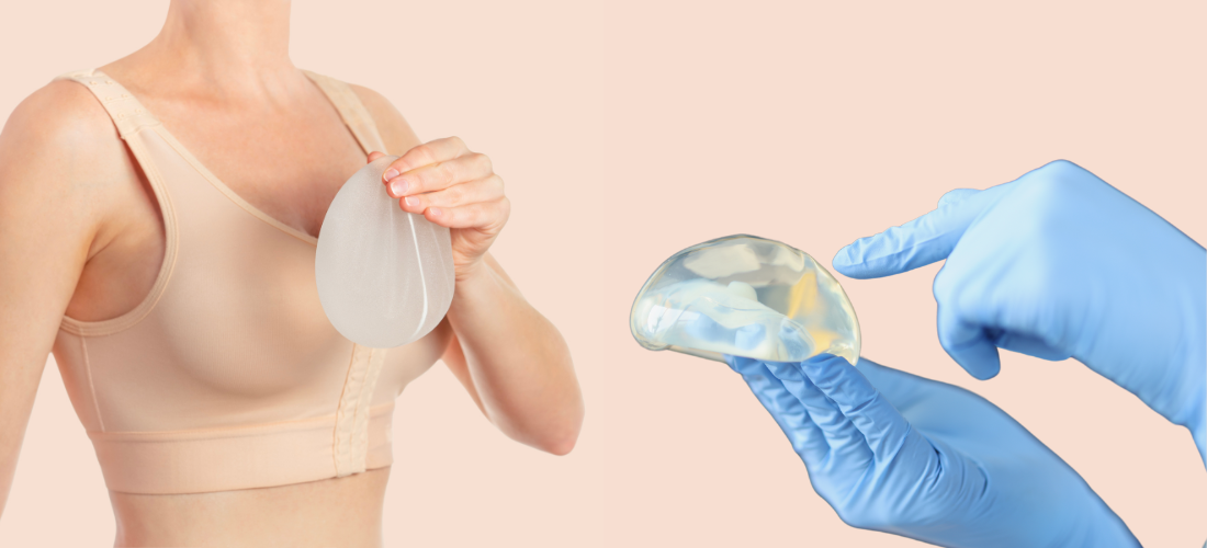 Breast Implant & Enhancement Surgery